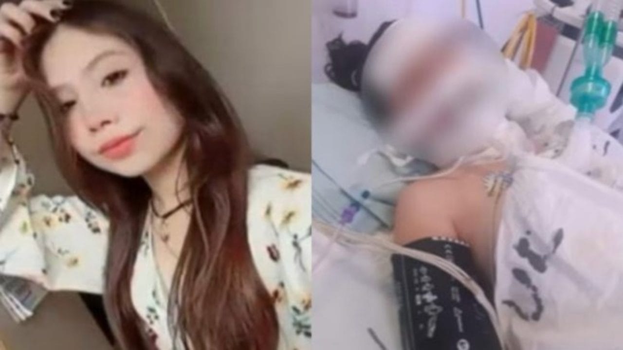 Fallece madre joven en Coahuila tras dolor de muelas: ¿Puede ser fatal?