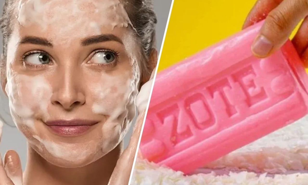 Dermatologist Debunks Zote Soap for Skin: Myths and Risks Explained