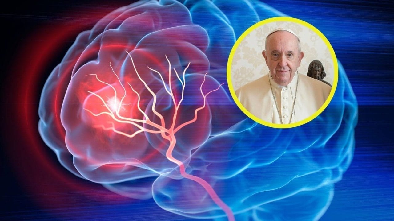 ¿Qué es un Ictus Cerebral? La emergencia médica del Papa Francisco