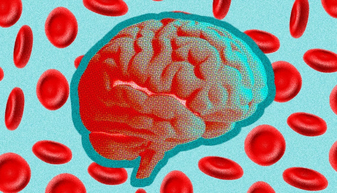 Alzheimer: Nuevo Test de Sangre lo Detecta con 95% de Precisión