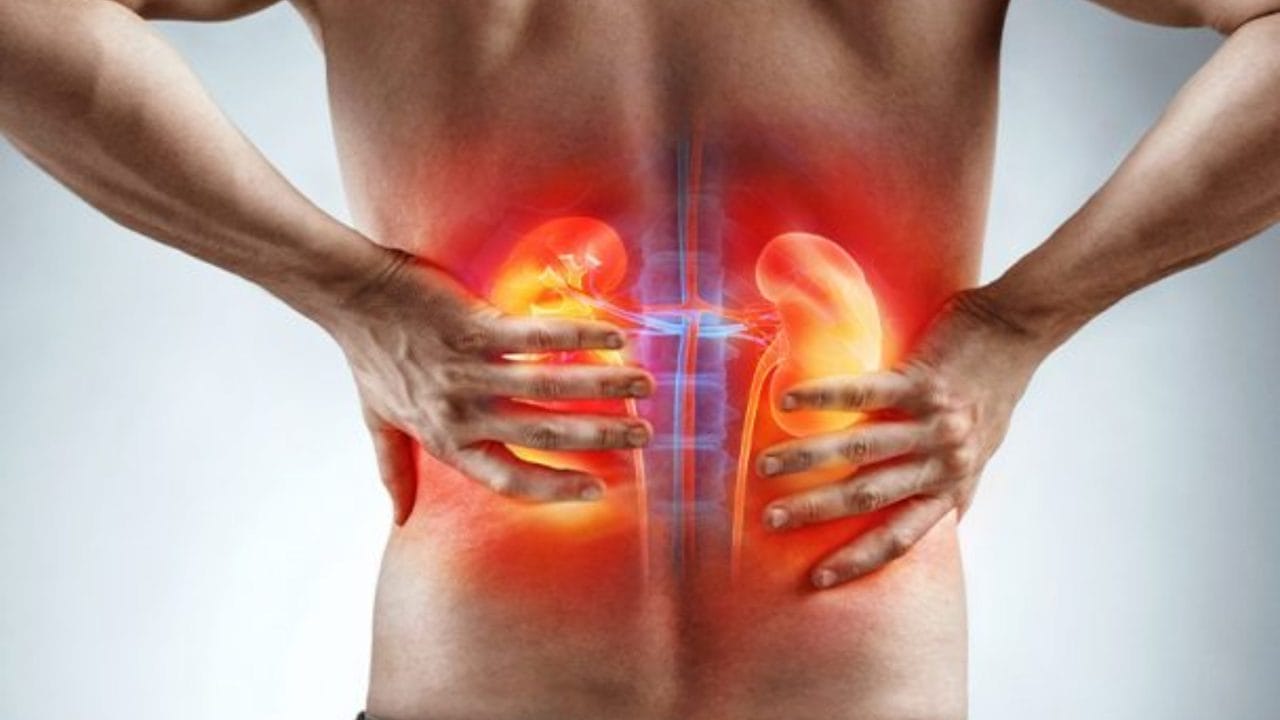 El cáncer de riñón, silencioso pero letal: ¿cómo detectarlo a tiempo?