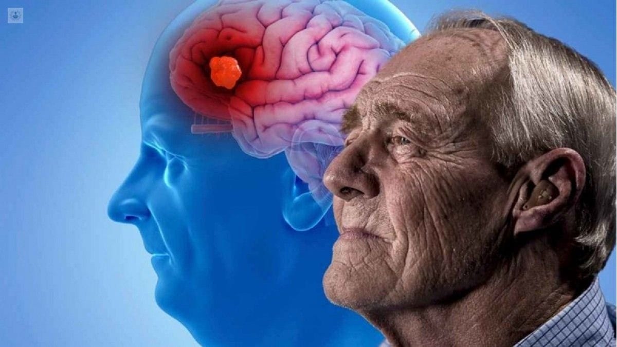 Alzheimer_Farmacos_para_el_cancer_revierten_sus_efectos_estudio Alzheimer: Fármacos para el cáncer revierten sus efectos en estudio