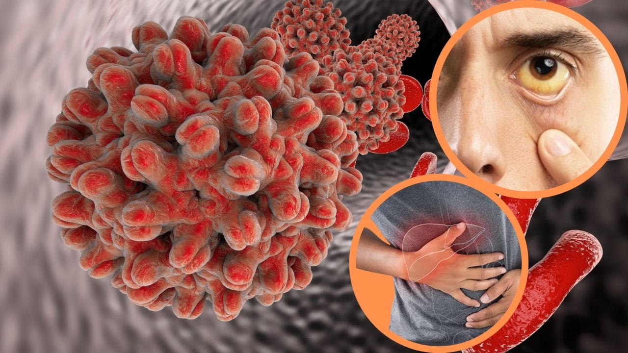 En México hay alrededor de 600 mil personas con Hepatitis C crónica, alertan autoridades En México hay alrededor de 600 mil personas con Hepatitis C crónica, alertan autoridades