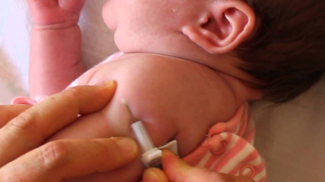 México confirma escasez mundial de vacuna BCG: ¿Están en riesgo los recién nacidos?