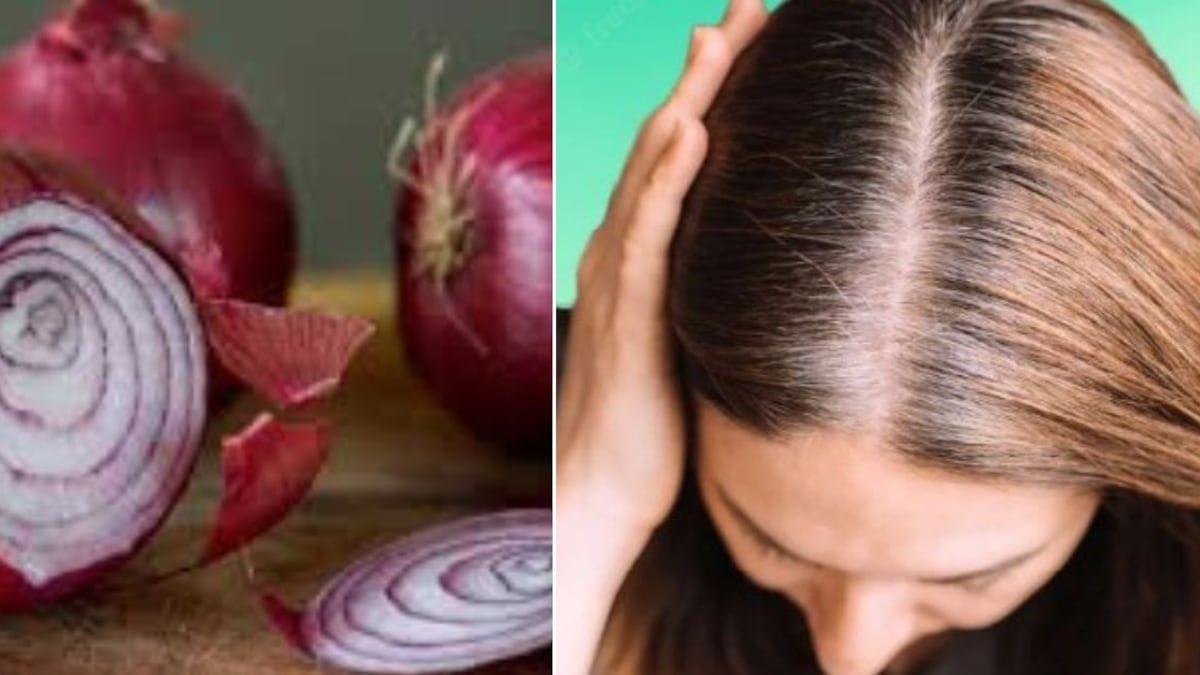 Agua de cebolla para prevenir la caída del cabello_ beneficios y cómo usarla Agua de cebolla para prevenir la caída del cabello: beneficios y cómo usarla