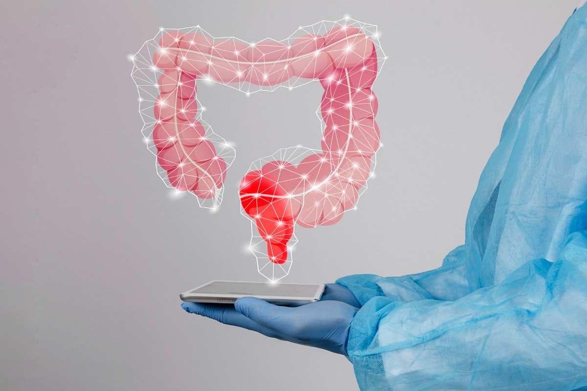 Cáncer de colon: 90% curable si se detecta a tiempo, alerta GEDYT