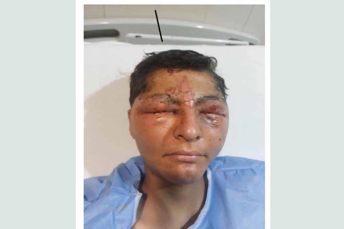 Madre denuncia negligencia tras accidente que dejó ciego a su hijo en escuela