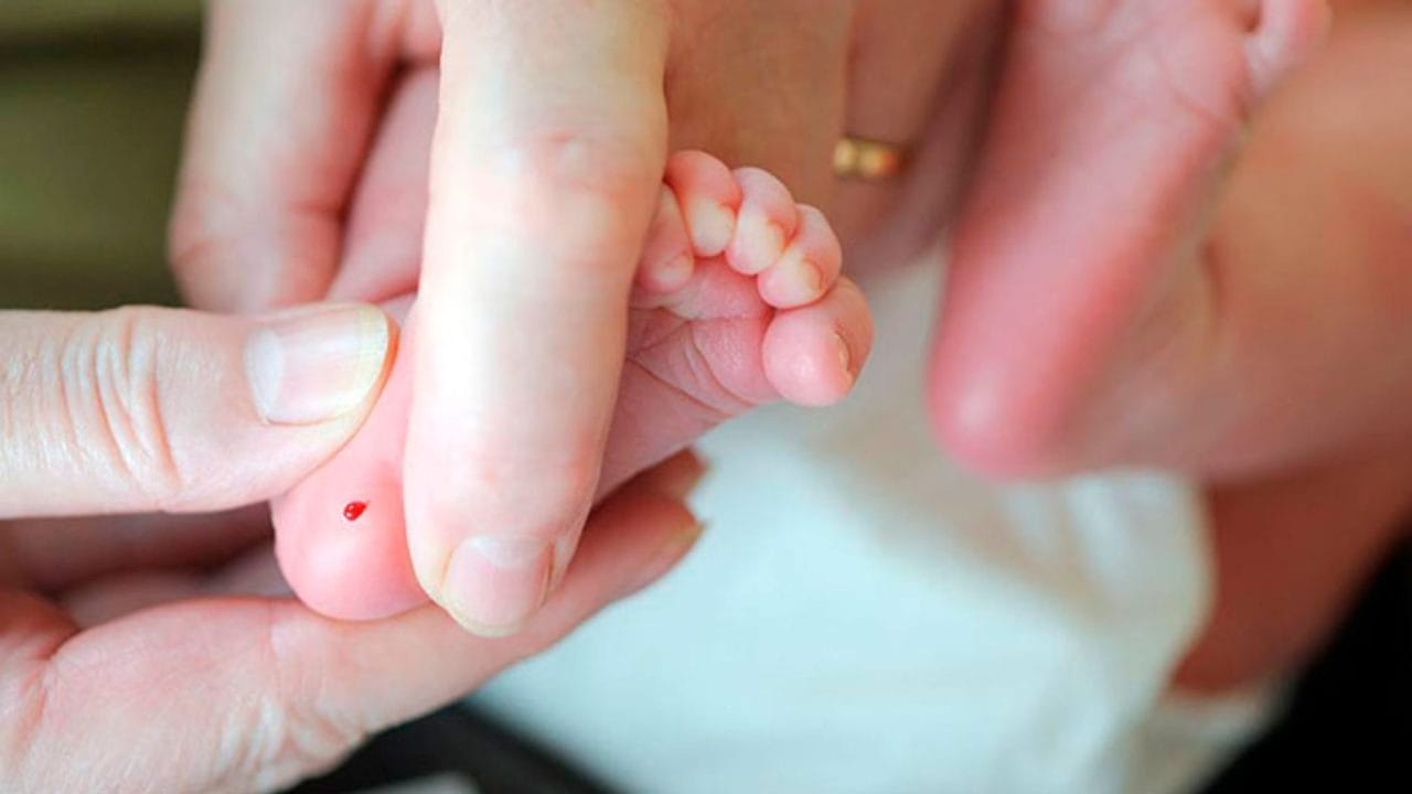 IMSS Quintana Roo refuerza tamiz neonatal para detección temprana de enfermedades