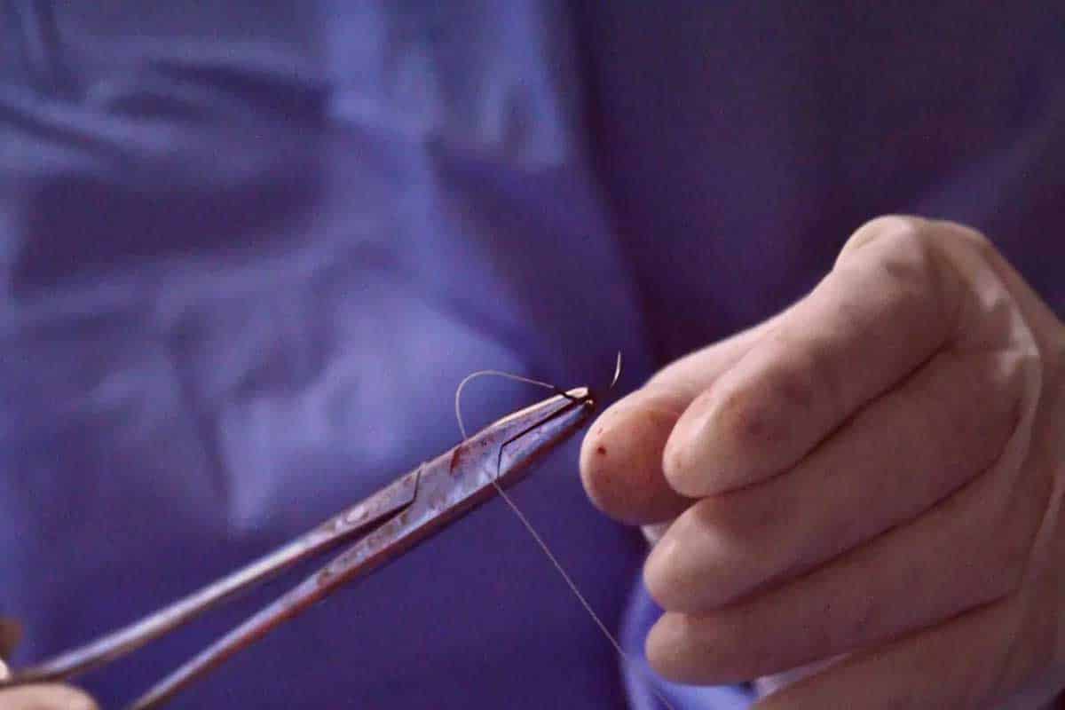 Adolescente muere tras cirugía estética sin consentimiento en Durango