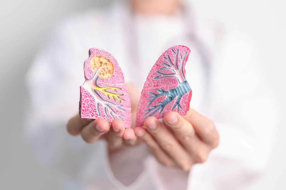 Alerta médica: subdiagnóstico de cáncer de pulmón afecta a no fumadores en México