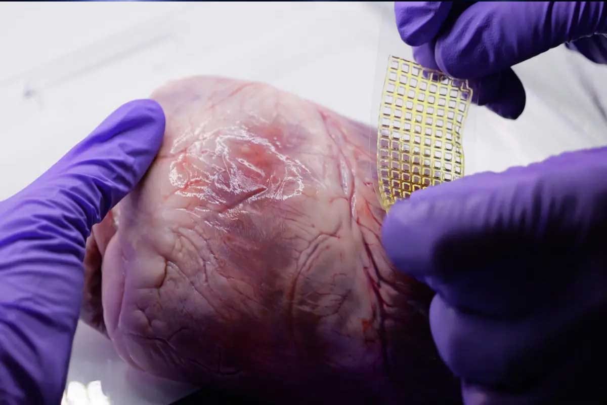Curita impresa en 3D revoluciona la reparación del corazón humano