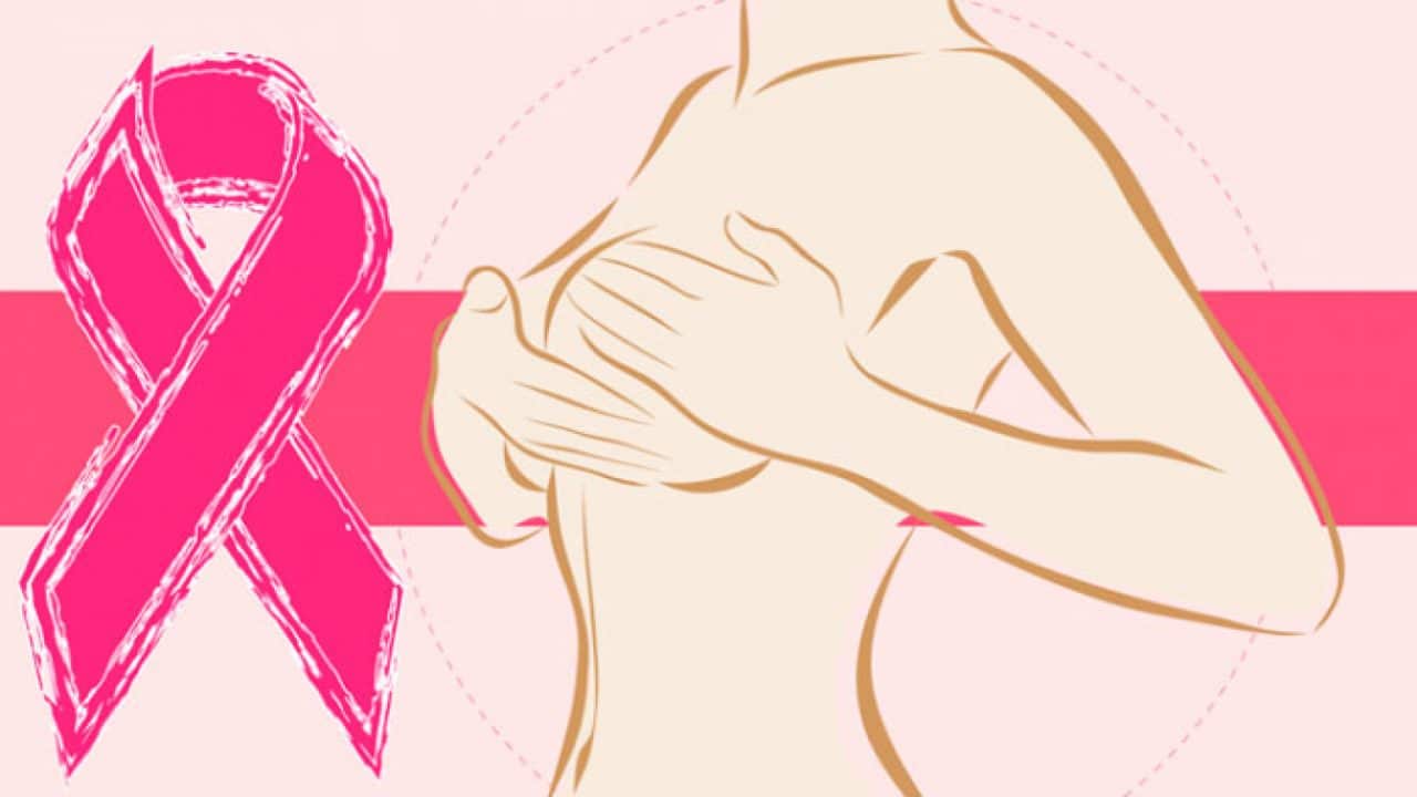 Cáncer de mama- Signos y síntomas que debes reconocer Cáncer de mama: Signos y síntomas que debes reconocer