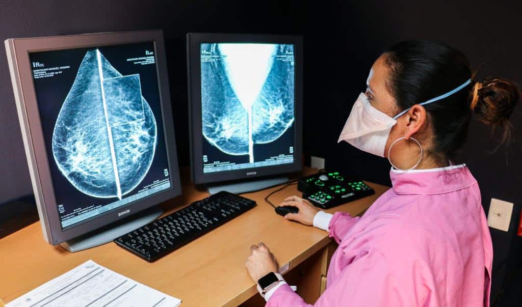 Mastografías en México: costos y dónde realizarlas