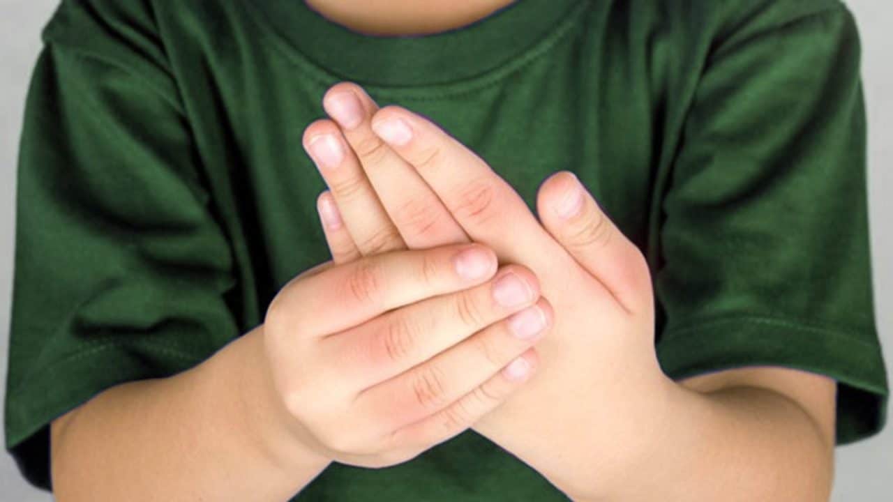 Artritis juvenil, una enfermedad silenciosa que limita a niñas y niños en México