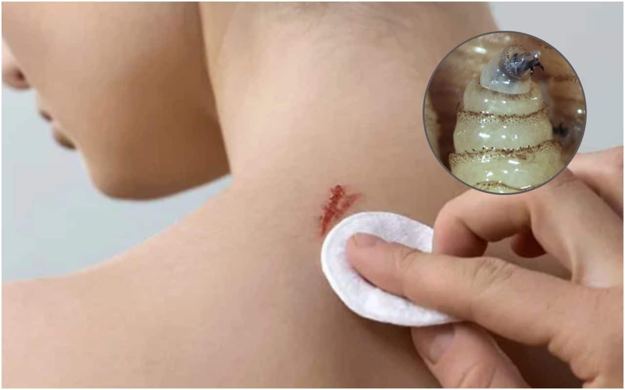 Yucatán registra quinto caso de gusano barrenador