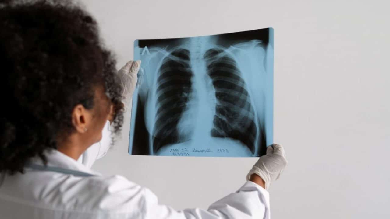 Cáncer de pulmón aumenta en la península y preocupa su avance entre jóvenes