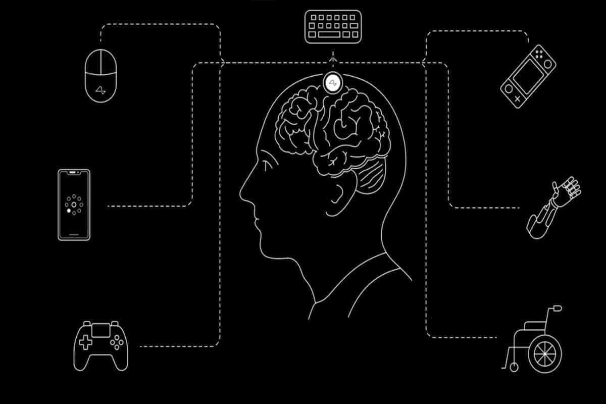 Elon Musk da avance revolucionario en implantes cerebrales