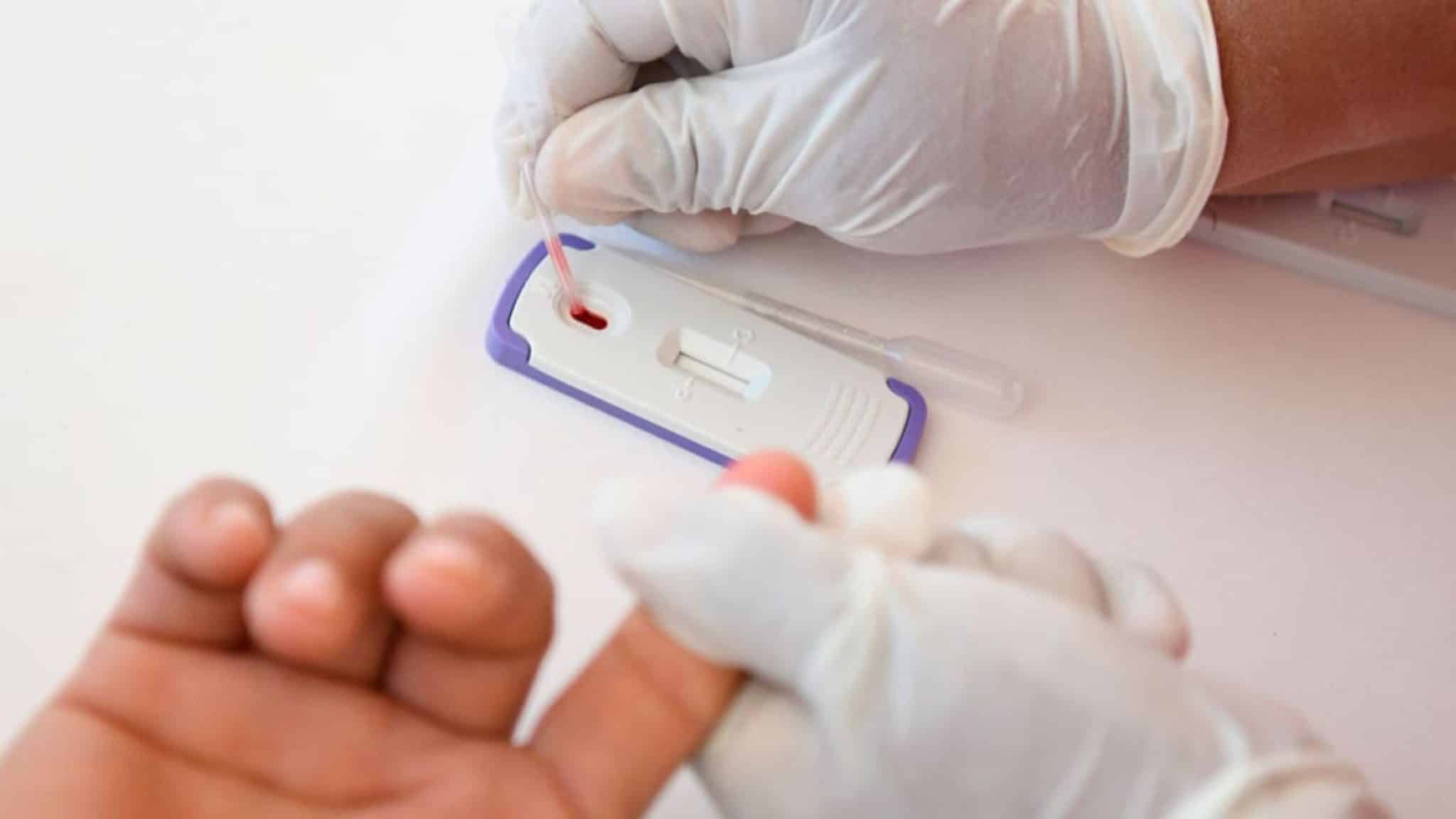 Península de Yucatán, casi 2 mil casos nuevos de VIH en 2025 Península de Yucatán, casi 2 mil casos nuevos de VIH en 2025