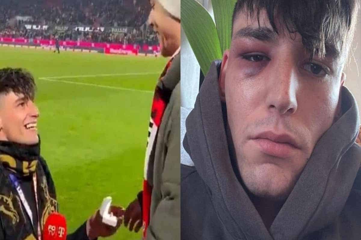 Árbitro agredido tras propuesta viral desata alarma global árbitro agredido tras propuesta viral desata alarma global