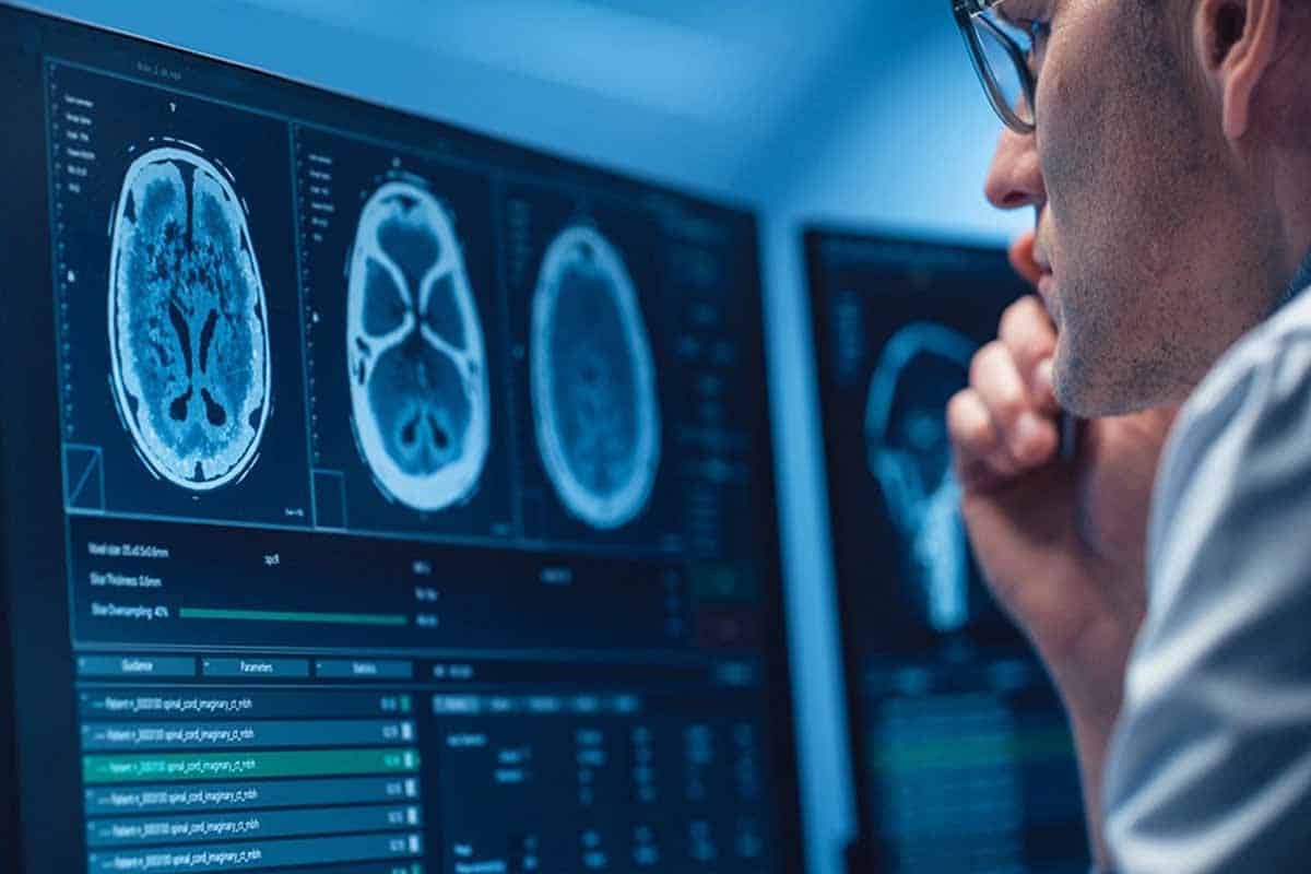 Cerebro humano revela por qué consume tanta energía Cerebro humano revela por qué consume tanta energía