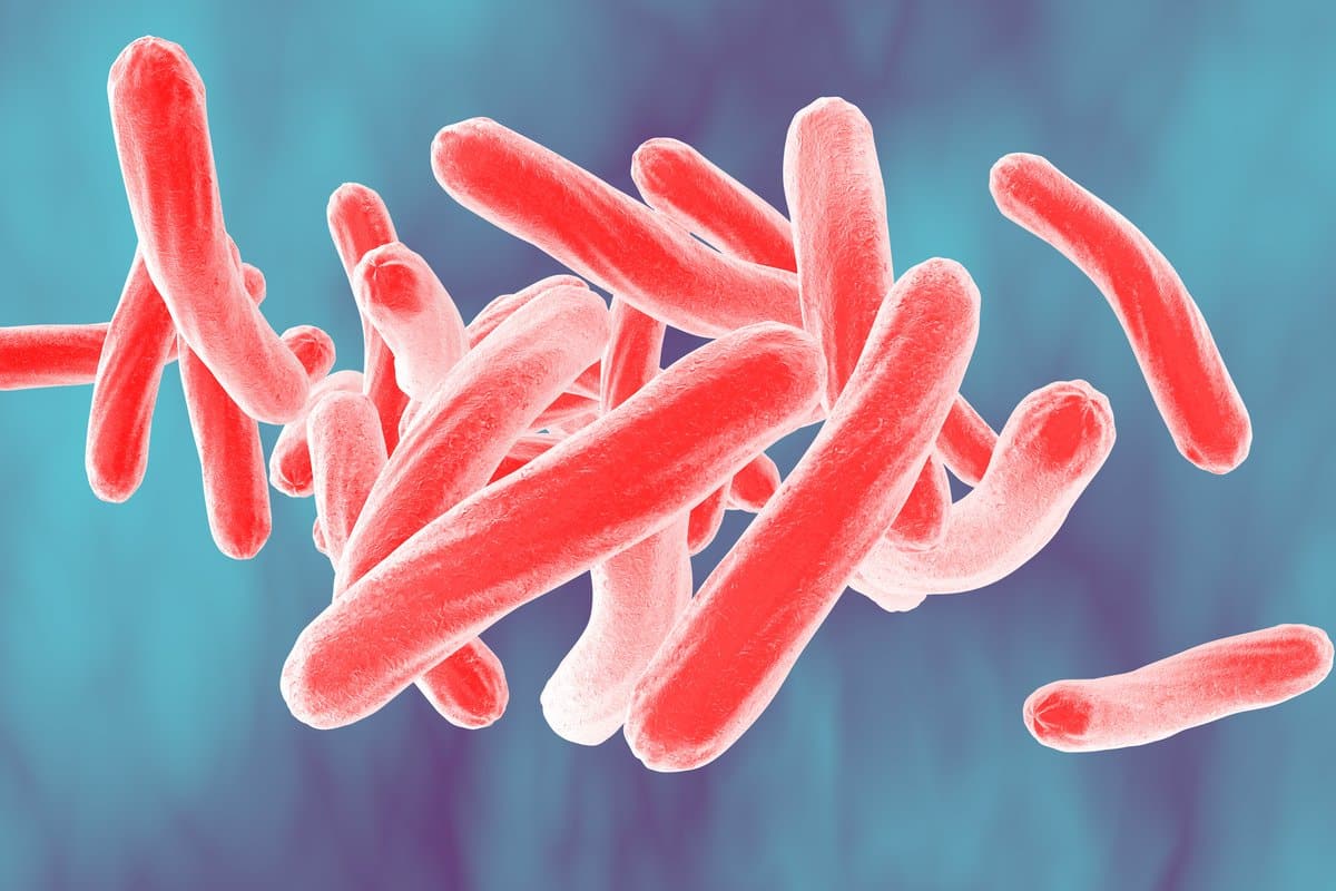 Tuberculosis en México- Por qué preocupa su aumento actual Tuberculosis en México: Por qué preocupa su aumento actual
