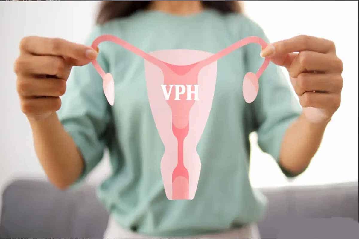 VPH y la nueva forma de diagnóstico temprano