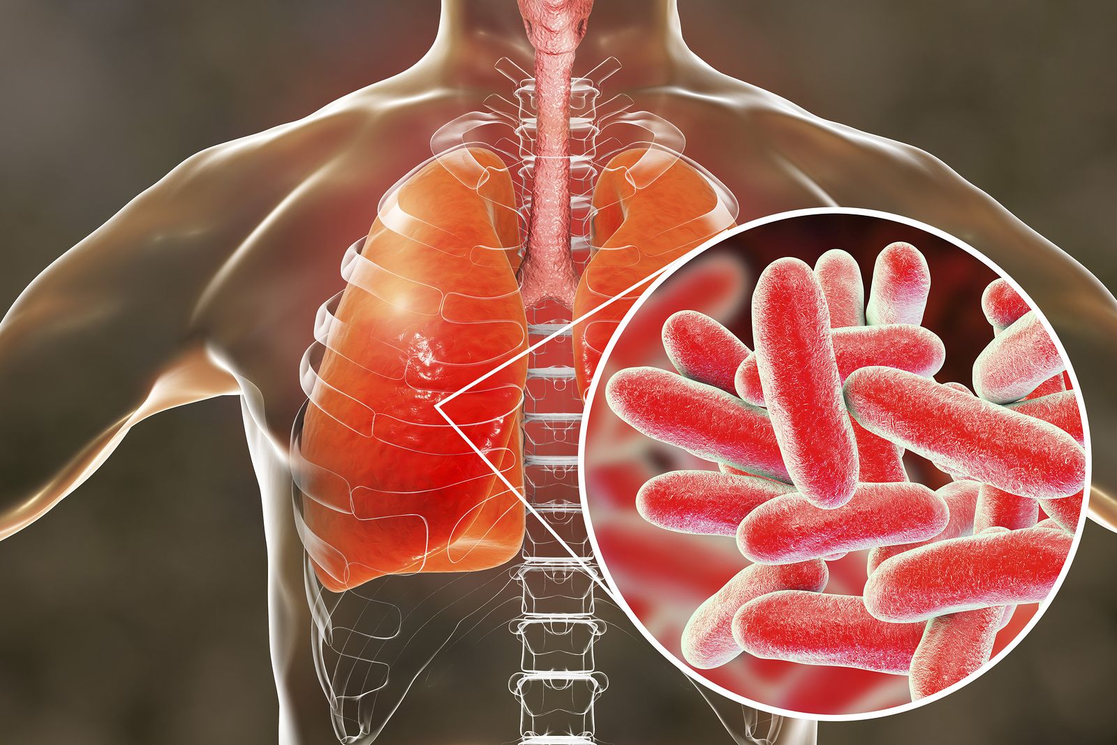 Bacteria Legionella cómo se transmite Suman 5 muertos ¿Qué es la Bacteria Legionella y cómo se transmite? Suman 5 muertos