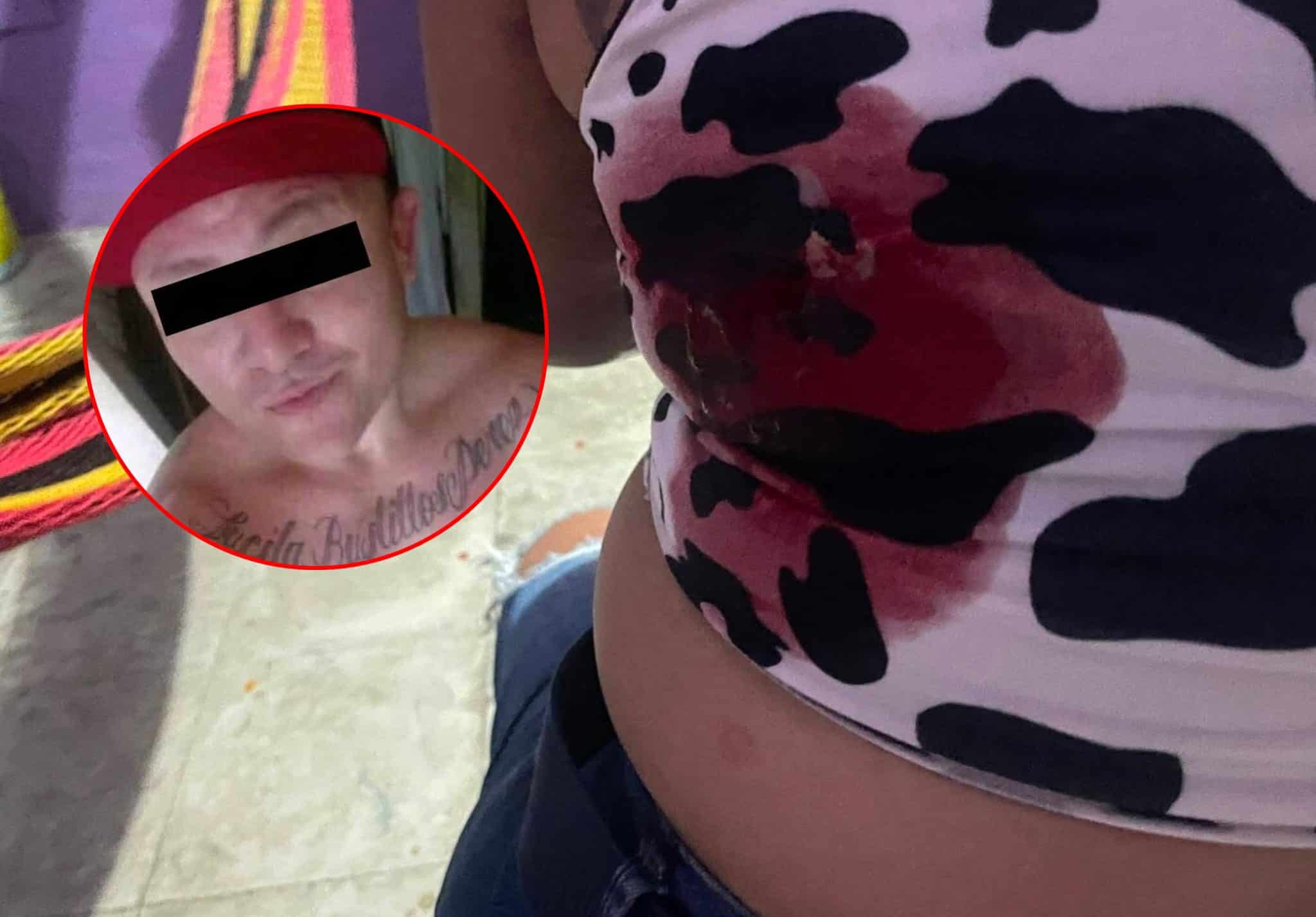 Investigan como tentativa de feminicidio ataque en Kanasín